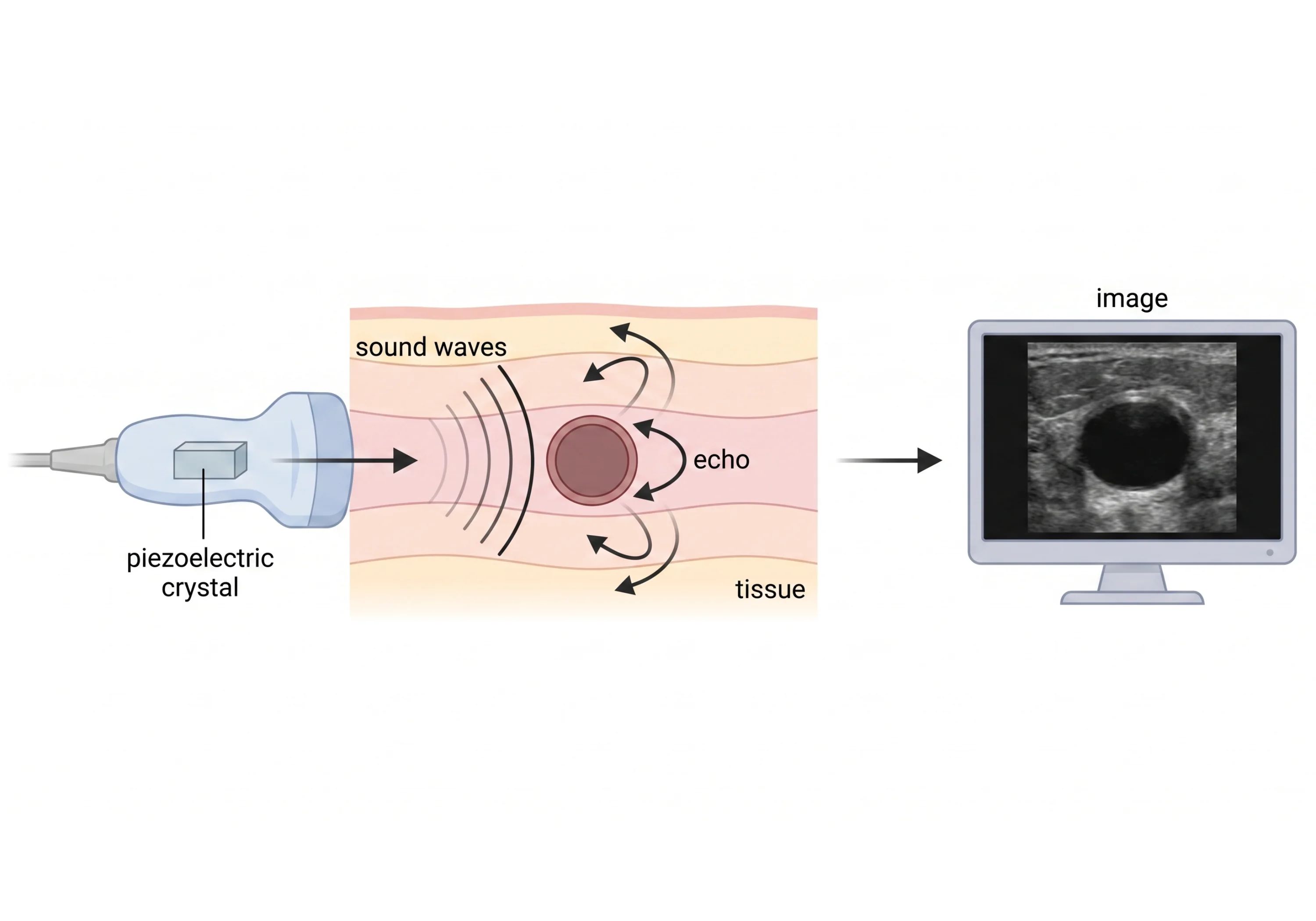 An illustration from VAC's ultrasound lesson showing how sound waves form an image